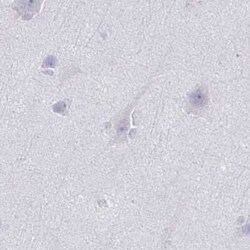 TEX44 Antibody, Novus Biologicals 0.1 mL, Unconjugated:Antibodies, Polyclonal