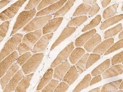 C5orf22 Antibody, Novus Biologicals 100 &mu;g, Unconjugated:Antibodies,