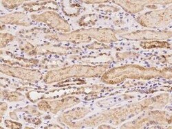 C5orf22 Antibody, Novus Biologicals 100 &mu;g, Unconjugated:Antibodies,