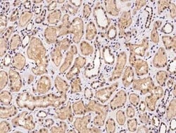 C5orf24 Antibody, Novus Biologicals 100 &mu;g, Unconjugated:Antibodies,