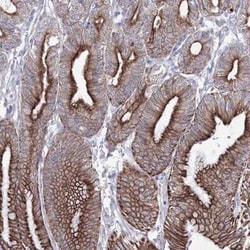 SMIM29 Antibody, Novus Biologicals 0.1 mL, Unconjugated:Antibodies, Polyclonal