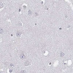 C6orf58 Antibody, Novus Biologicals:Antibodies:Primary Antibodies