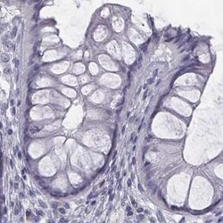 C6orf58 Antibody, Novus Biologicals:Antibodies:Primary Antibodies