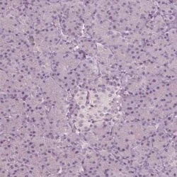 CCDC170 Antibody, Novus Biologicals 0.1 mL, Unconjugated:Antibodies, Polyclonal