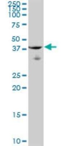ARHGEF39 Antibody, Novus Biologicals 0.05 mg | Buy Online | Novus Biologicals | Fisher Scientific