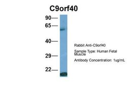 C9orf40 Rabbit anti-Human, Polyclonal, Novus Biologicals 0.1 mL | Buy Online | Novus Biologicals | Fisher Scientific