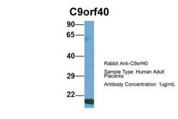 C9orf40 Rabbit anti-Human, Polyclonal, Novus Biologicals 0.1 mL | Buy Online | Novus Biologicals | Fisher Scientific
