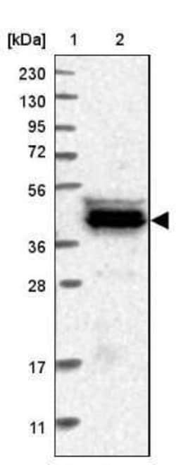 CARNMT1 Antibody, Novus Biologicals 25 &mu;L | Buy Online | Novus Biologicals | Fisher Scientific