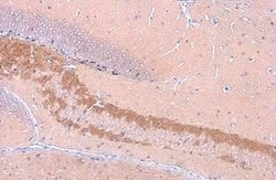 C9orf72 Antibody (GT1553), Novus Biologicals 100 &mu;g; Unconjugated:Antibodies,