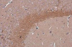 C9orf72 Antibody (GT1553), Novus Biologicals 100 &mu;g; Unconjugated:Antibodies,