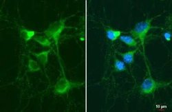 C9orf72 Antibody (779), Novus Biologicals 100 &mu;g; Unconjugated:Antibodies,