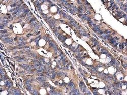 C9orf72 Antibody (779), Novus Biologicals 100 &mu;g; Unconjugated:Antibodies,