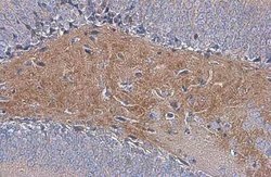 C9orf72 Antibody (779), Novus Biologicals 100 &mu;g; Unconjugated:Antibodies,