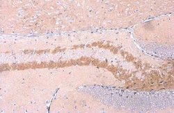 C9orf72 Antibody (779), Novus Biologicals 100 &mu;g; Unconjugated:Antibodies,