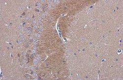C9orf72 Antibody (779), Novus Biologicals 100 &mu;g; Unconjugated:Antibodies,