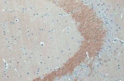 C9orf72 Antibody (779), Novus Biologicals 100 &mu;g; Unconjugated:Antibodies,