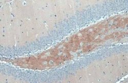 C9orf72 Antibody (779), Novus Biologicals 100 &mu;g; Unconjugated:Antibodies,
