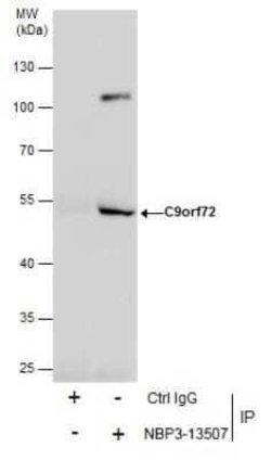 C9orf72 Antibody (779), Novus Biologicals 100 &mu;g; Unconjugated:Antibodies,