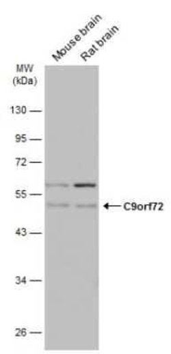 C9orf72 Antibody (779), Novus Biologicals 100 &mu;g; Unconjugated:Antibodies,