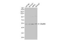 C9orf72 Antibody (779), Novus Biologicals 100 &mu;g; Unconjugated:Antibodies,