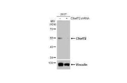 C9orf72 Antibody (779), Novus Biologicals 100 &mu;g; Unconjugated:Antibodies,