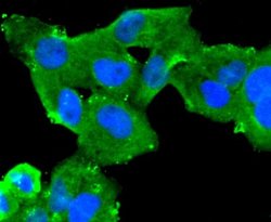 CA125/MUC16 Antibody (SN0715), Novus Biologicals 100&mu;L:Antibodies, Monoclonal