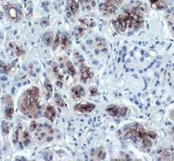 CA19-9/Sialyl Lewis A Antibody (GT933), Novus Biologicals 100 &mu;g; Unconjugated:Antibodies,