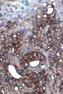 CA19-9/Sialyl Lewis A Antibody (GT933), Novus Biologicals 100 &mu;g; Unconjugated:Antibodies,