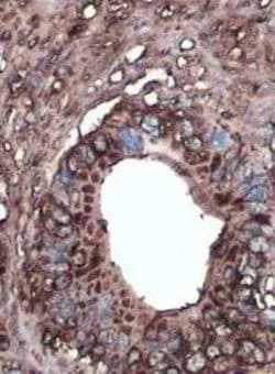 CA19-9/Sialyl Lewis A Antibody (GT933), Novus Biologicals 100 &mu;g; Unconjugated:Antibodies,