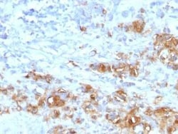 CA19-9/Sialyl Lewis A Antibody (CA19.9/1390R), Novus Biologicals:Antibodies:Primary