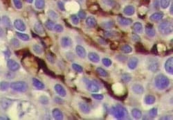 CA19-9/Sialyl Lewis A Antibody (CA19.9/1390R), Novus Biologicals:Antibodies:Primary