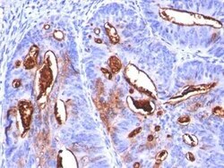 CA19-9/Sialyl Lewis A Antibody (SPM588), Novus Biologicals 0.1mg; Unlabeled:Antibodies,