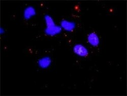 CAB39 Antibody, Novus Biologicals 0.05 mg | Buy Online | Novus Biologicals | Fisher Scientific