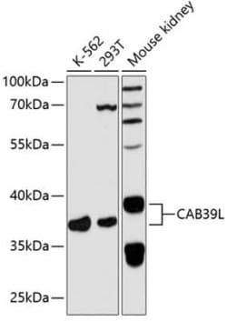 CAB39L Antibody - Azide and BSA Free, Novus Biologicals 0.1 mL, Unconjugated:Antibodies,