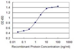 CABP4 Antibody (3B3), Novus Biologicals 0.1 mg | Buy Online | Novus Biologicals | Fisher Scientific