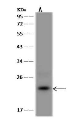 CABP5 Antibody, Novus Biologicals:Antibodies:Primary Antibodies