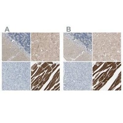CACNA2D1 Antibody, Novus Biologicals 25 &mu;L | Buy Online | Novus Biologicals | Fisher Scientific