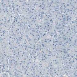CACNA2D1 Antibody, Novus Biologicals 25 &mu;L | Buy Online | Novus Biologicals | Fisher Scientific