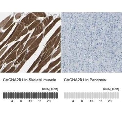 CACNA2D1 Antibody, Novus Biologicals 25 &mu;L | Buy Online | Novus Biologicals | Fisher Scientific