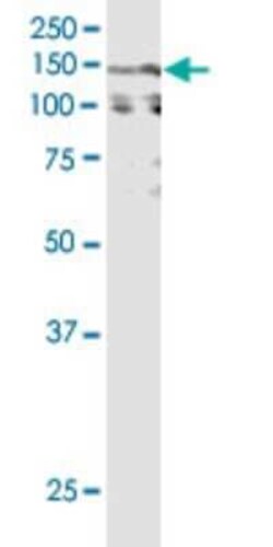 Novus Biologicals CACNA2D2 Antibody (3A4), Novus Biologicals 0.1 mg | Buy Online | Novus Biologicals&trade; | Fisher Scientific