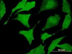 CACNA2D2 Antibody (4E3), Novus Biologicals 50 &mu;g | Buy Online | Novus Biologicals | Fisher Scientific