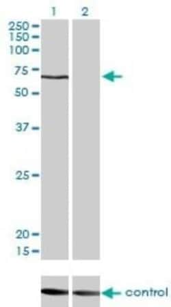 Novus Biologicals CACNB1 Antibody (1G6), Novus Biologicals 0.1 mg | Buy Online | Novus Biologicals&trade; | Fisher Scientific