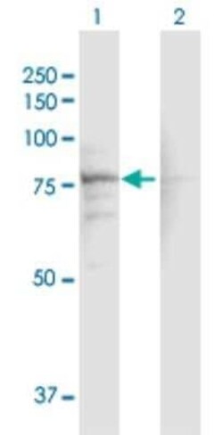 CACNB1 Antibody, Novus Biologicals 0.1 mg | Buy Online | Novus Biologicals | Fisher Scientific