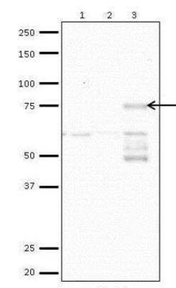 CACNB2 Antibody (6C4), Novus Biologicals 0.1 mg | Buy Online | Novus Biologicals | Fisher Scientific