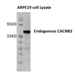 CACNB2 Antibody (6C4), Novus Biologicals 0.1 mg | Buy Online | Novus Biologicals | Fisher Scientific
