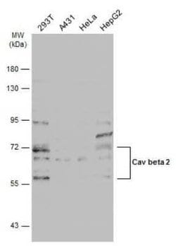 CACNB2 Antibody, Novus Biologicals 100 μg; Unconjugated:Antibodies,
