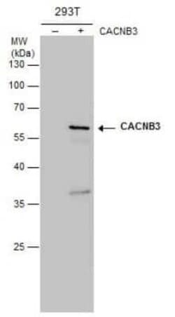 CACNB3 Antibody (7D1), Novus Biologicals 100 &mu;g; Unconjugated:Antibodies,