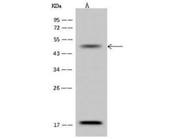 CACNB3 Antibody, Novus Biologicals™