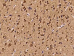 CACNB4 Antibody, Novus Biologicals 50 &mu;g, Unconjugated:Antibodies, Polyclonal