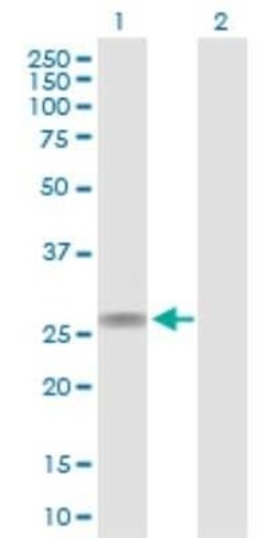 CACNG1 Antibody, Novus Biologicals 0.1 mg | Buy Online | Novus Biologicals | Fisher Scientific